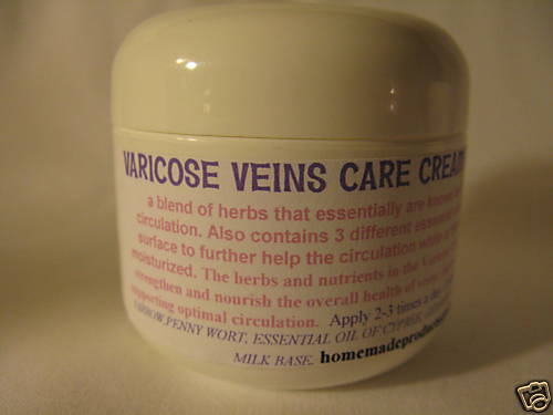 VARICOSE VEINS CARE CREAM BAD CIRCULATION LEGS VESSELS  